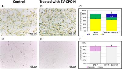 Human Cardiac Progenitor Cell-Derived Extracellular Vesicles Exhibit Promising Potential for Supporting Cardiac Repair in Vitro